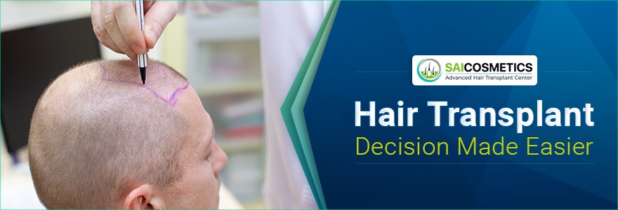 Hair Transplant Decision Made Easier