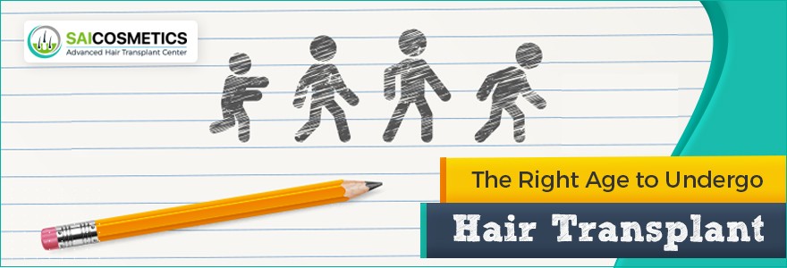 The Right Time to Undergo Hair Transplant Treatment